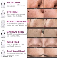 Classic Acne PCENF5334 Treatment Devices*Capacity: 150gIdeal For: UnisexNet Quantity (N): 1Dispatch: 2 Days*Proof of Safe Delivery! Click to know on Safety Standards of Delivery Partners- https://ltl.sh/y_nZrAV3