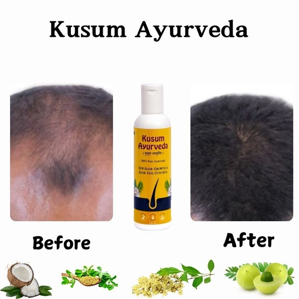 Kusum Ayurvedic Hair Oil