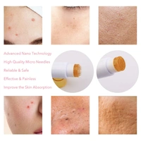 Derma Stamp 1.5 MM With Titanium Needles For Acne Scars, Wrinkles,Hair Regrowth - 1.5 mm, White