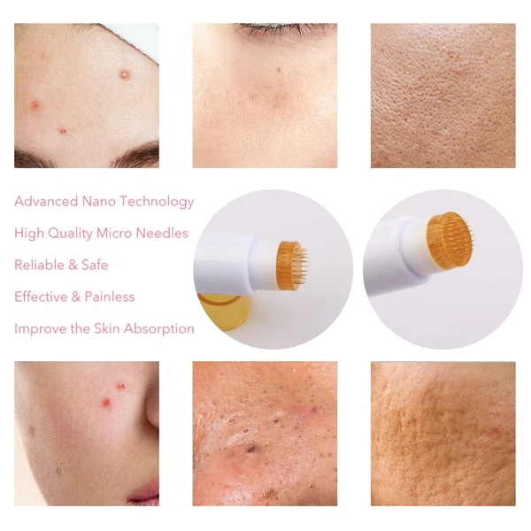 Derma Stamp 1.5 MM With Titanium Needles For Acne Scars, Wrinkles,Hair Regrowth - 1.5 mm, White