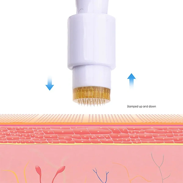 Derma Stamp 1.5 MM With Titanium Needles For Acne Scars, Wrinkles,Hair Regrowth - 1.5 mm, White