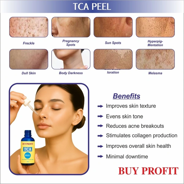 TCA 35 % Chemical Peel For Scars, Dark spots, Pigmentation, Peeling Etc