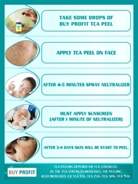 TCA 35 % Chemical Peel For Scars, Dark spots, Pigmentation, Peeling Etc