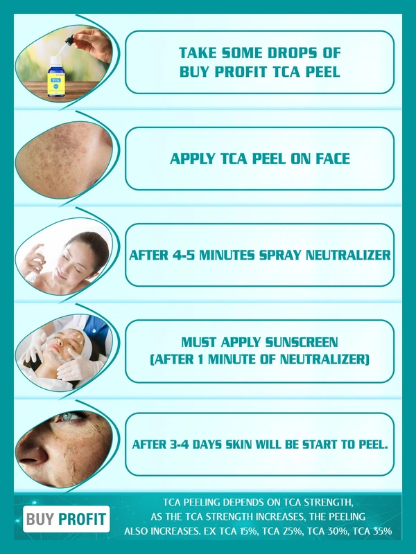 TCA 35 % Chemical Peel For Scars, Dark spots, Pigmentation, Peeling Etc