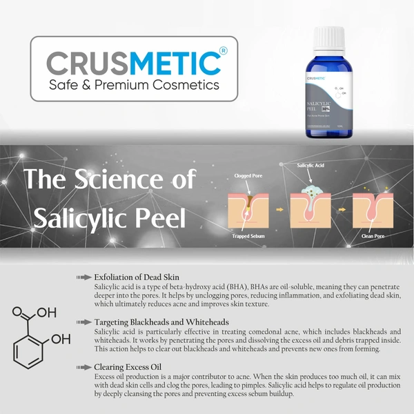 Salicylic Peel 30% For Pimples 10 ML