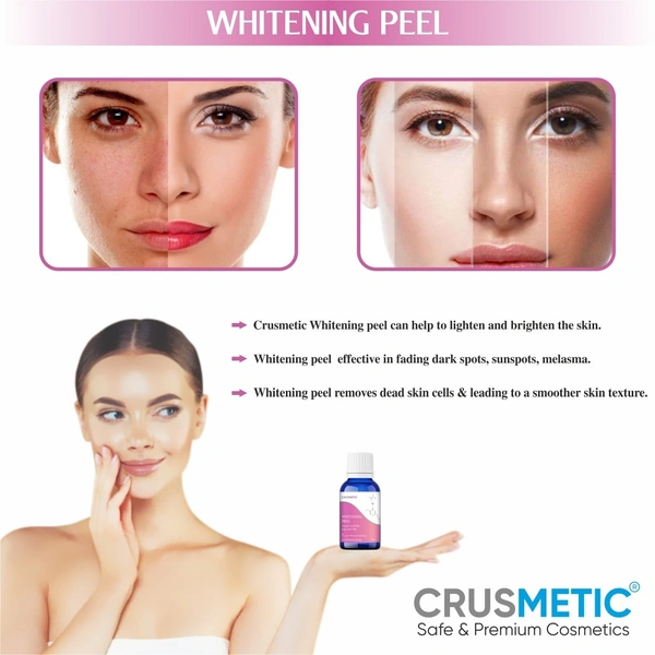 Whitening Peel 10ML- Glowing Formula