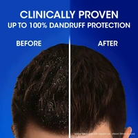 Head & Shoulders , Anti Dandruff Shampoo, Cool Menthol , 180 ML - 180 Ml