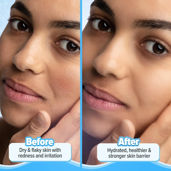 Aqualogica 5 Barrier+ Repair Moisturizer 100g | With Avocado & 5 Essential Ceramides | Repairs, Strengthens & Hydrates Skin Barrier | Non-Sticky | For All Skin Types