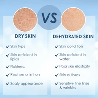 Cetaphil Optimal Hydration Activation Serum 30 ml