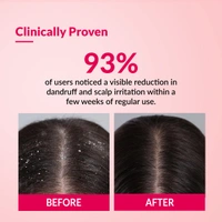 Fixderma Bioteez-S Anti Dandruff Shampoo 75ml | Controls Recurrent Dandruff, Reduces Flaky Scalp, Relieves Itchy & Dry Scalp | Nourishes Hair | Sulphate & Paraben Free