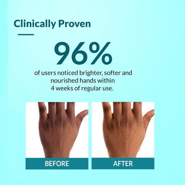 Fixderma Brightening Hand Cream 30 gm | Kojic Acid & SPF 50 | Moisturizer for Dry, Rough & Itchy Hands | Brightening Hand Cream for Men & Women | All Skin Types