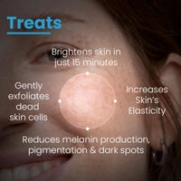 Fixderma Cosmetics Laboratories Fixderma Cosmetic LaboratoriesBrightening Face Mask 100gm| Kojic Acid Mask With Hyaluronic Acid | PHA, BHA & AHA Exfoliates Dead Skin, Tightens Pores & Boosts Glow