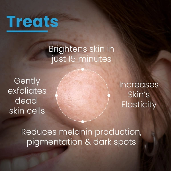 Fixderma Cosmetics Laboratories Fixderma Cosmetic LaboratoriesBrightening Face Mask 100gm| Kojic Acid Mask With Hyaluronic Acid | PHA, BHA & AHA Exfoliates Dead Skin, Tightens Pores & Boosts Glow