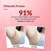 Fixderma Nigrifix Underarm Velvet Musk Roll On 60ml with 6% AHA, Lactic Acid, 1% Mandelic Acid & Kojic Acid | Brightens, Exfoliates & Smoothens Dark Underarms | Sensitive Skin Safe