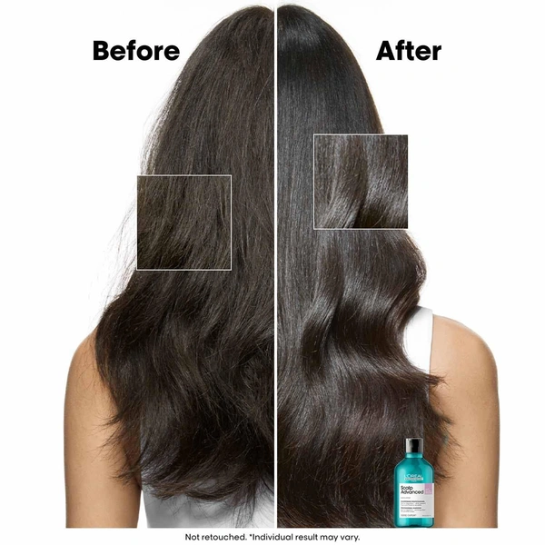 Loreal Professionnel Paris Loreal Professionnel Scalp Advanced Anti-Discomfort Shampoo 300ml |For Sensitive Scalp