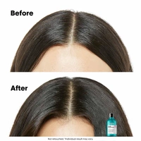 Loreal Professionnel Paris Loreal Professionnel Scalp Advanced Anti-Discomfort Shampoo 300ml |For Sensitive Scalp