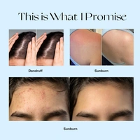 Nourish Mantra Super Skin Healing Spray 30ml | 10-in-1 Multipurpose Solution | Acne, Cuts & Dandruff | Psoriasis & Insect Bites, Bumps & More | Natural & Gentle