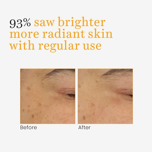 O3+ Professional O3+ Vitamin- C & Turmeric Glow Gel Cream 50g