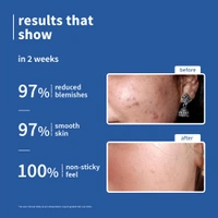 Plum 10% Niacinamide Serum with Rice Water 15ml | Brightening, Clear & Glowing Skin | Anti-Acne & Oil Control Serum for Acne-Prone, Oily, Combination & Sensitive Skin