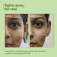 Plum Green Tea Pore Cleansing Face Wash 50ml | With Glycolic Acid | Fights Pimples & Controls Excess Oil | Gentle Exfoliating, Non-Drying | For Oily, Acne-Prone & Combination Skin | Vegan | Women & Men