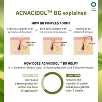 Plum Green Tea & Zinc Complex 3% Serum 30ml | Fights Pimples & Controls Oil | With Acnacidol� BG & Natural AHAs | Tightens Pores & Gently Exfoliates