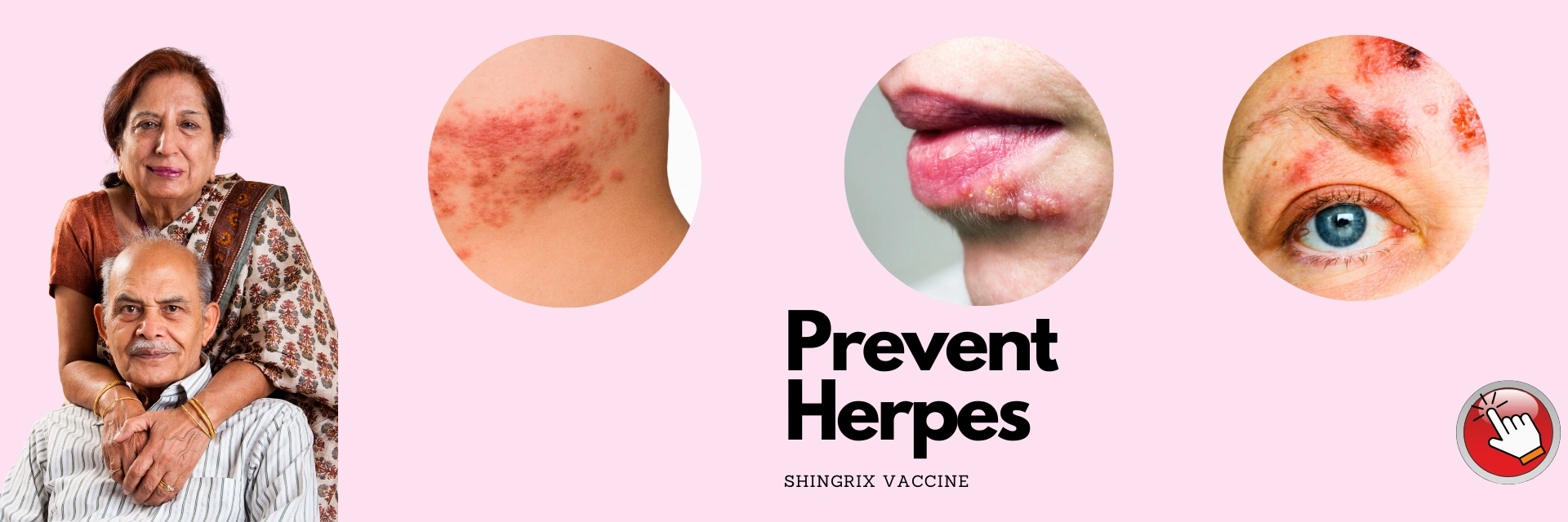 Herpes Vaccine