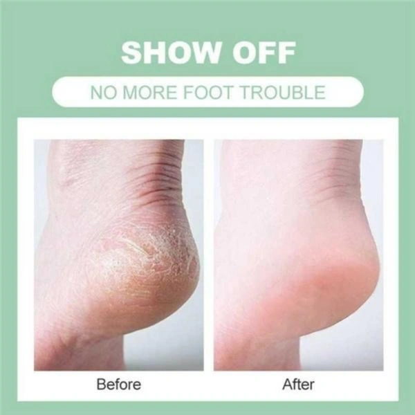 Silicon Gel Heel Pad