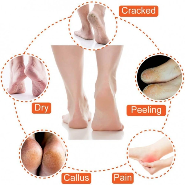 Gel Heel Socks 