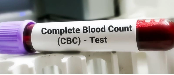 Complete Blood Count (CBC) Test 