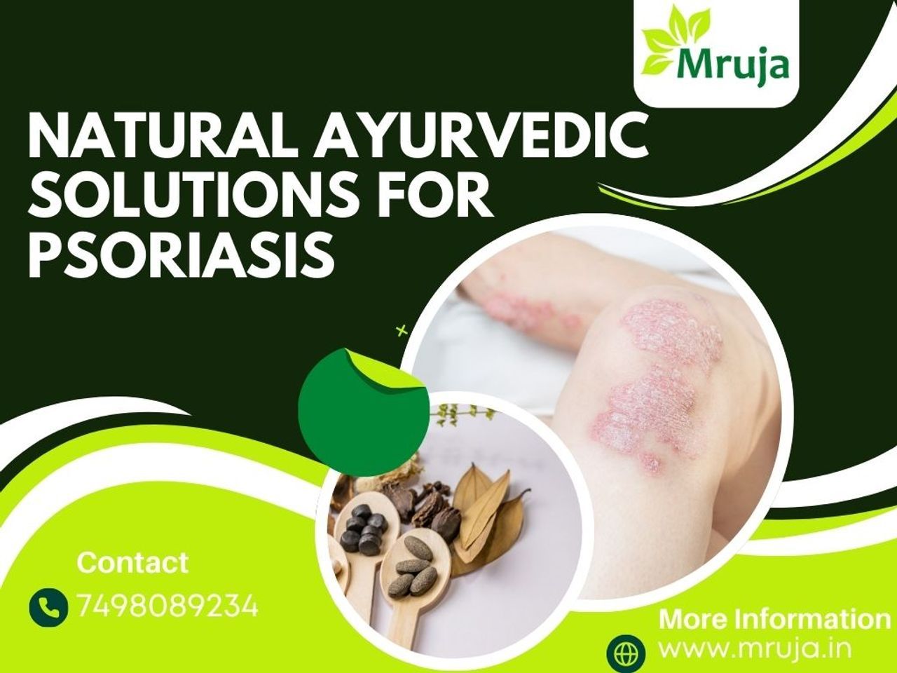 Ayurveda for Psorisis