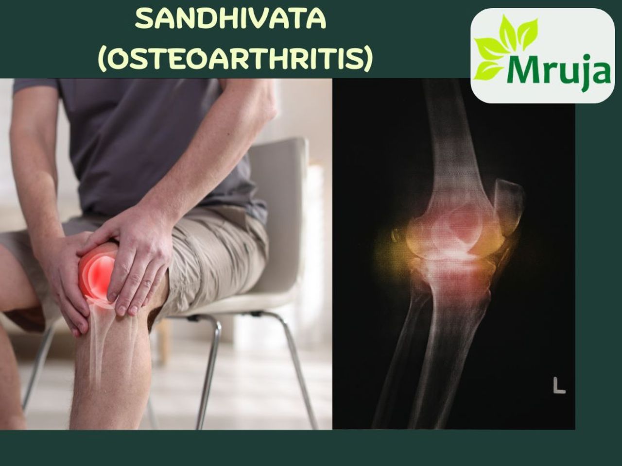 SANDHIVATA (OSTEOARTHRITIS) Comprehensive Ayurvedic Management with Satiost Range