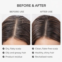 Premium Silicone Scalp Massager Brush | Soft Bristle Hair & Body Cleaning Brush | Handheld Shower Scrubber for Deep Cleansing & Relaxation (White)