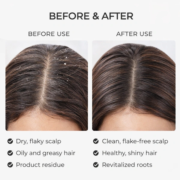 Premium Silicone Scalp Massager Brush | Soft Bristle Hair & Body Cleaning Brush | Handheld Shower Scrubber for Deep Cleansing & Relaxation (White)