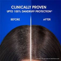 Head & Shoulder's Anti - Dandruff Shampoo Anti - Hairfall - 340 ml - 340 ml