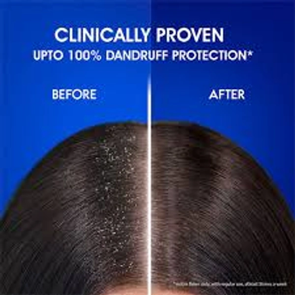 Head & Shoulder's Anti - Dandruff Shampoo Anti - Hairfall - 340 ml - 340 ml