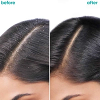 Matrix Biolage Scalppure Anti Dandruff Shampoo 200ml