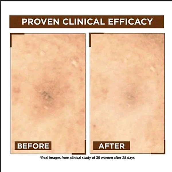 Garnier Bright Complete Night Vitamin C Serum With 10% Pure Vitamin C for Bright Skin, 15ml - 15ml