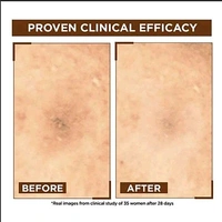 Garnier Bright Complete Night Vitamin C Serum With 10% Pure Vitamin C for Bright Skin, 15ml - 30ml