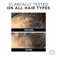 L'Oreal Paris Anti-Hair Fall Shampoo, Reinforcing & Nourishing for Hair Growth, For Thinning & Hair Loss, With Arginine Essence and Salicylic Acid, Fall Resist 3X, 180 ml 89015261023227