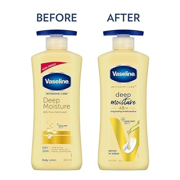 Vaseline Intensive Care Deep Moisture Nourishing Body Lotion 400 ml, Daily Moisturizer for Dry Skin, Gives Non-Greasy, Glowing Skin - For Men & Women 8901030971839