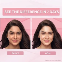 POND'S Pond's Bright Beauty Anti-Spot Serum Cream with Niacinamide and SPF 15 PA++, Fades Dark Spots and Reveals Bright Skin, 50g - 50g, Pink