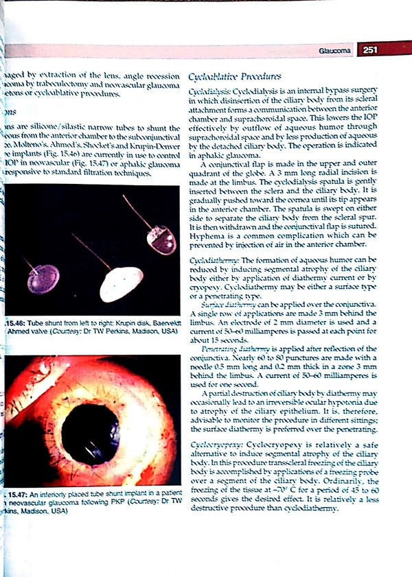 Textbook of Ophthalmology