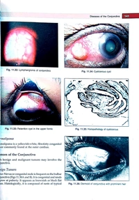 Textbook of Ophthalmology