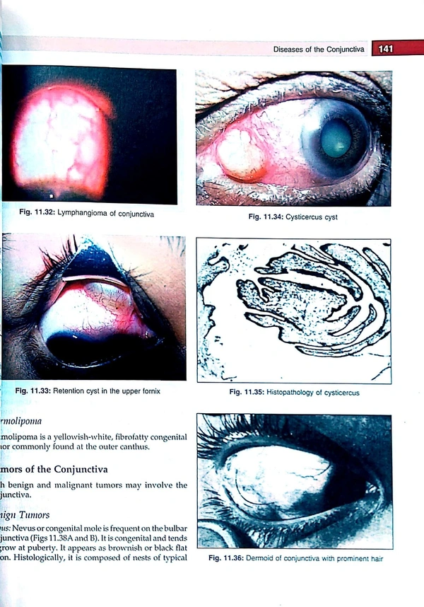 Textbook of Ophthalmology