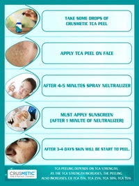 CRUSMETIC TCA 25% Peel- Exfoliate to Skin