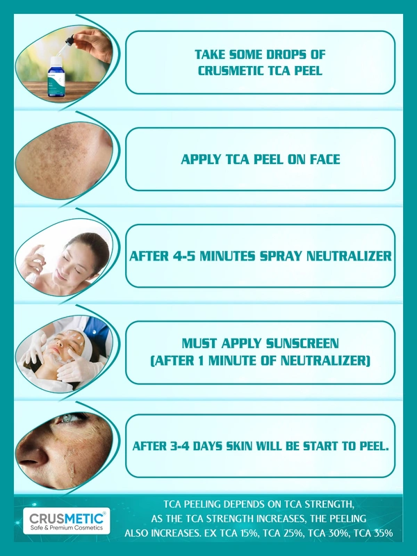 CRUSMETIC TCA 25% Peel- Exfoliate to Skin