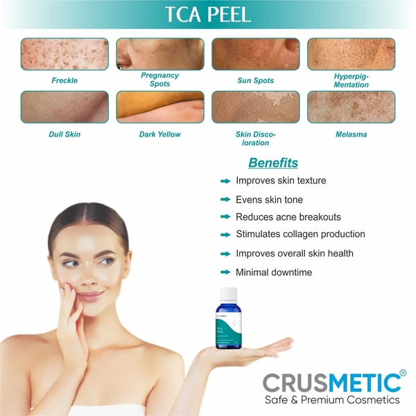 CRUSMETIC TCA 25% Peel- Exfoliate to Skin