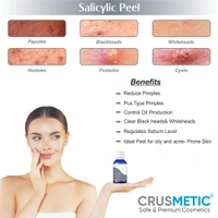 Crusmetic Salicylic Peel 15% - Advanced Acne Treatment Formula