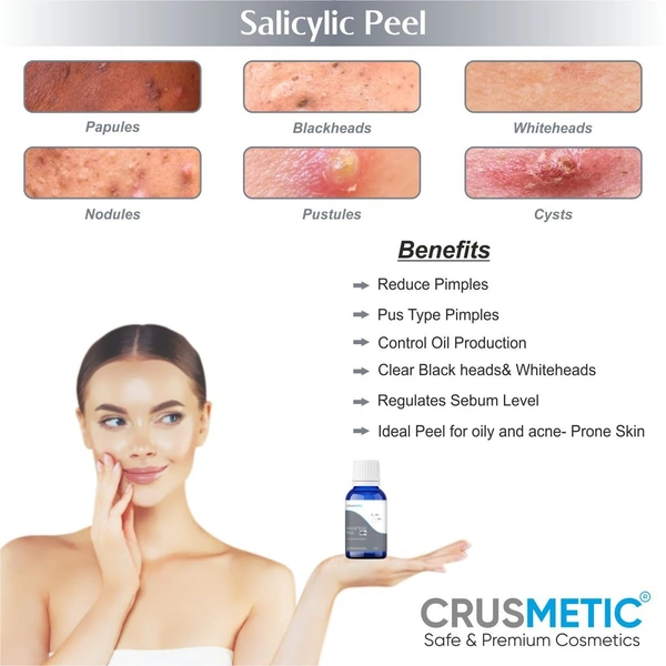 Crusmetic Salicylic Peel 15% - Advanced Acne Treatment Formula