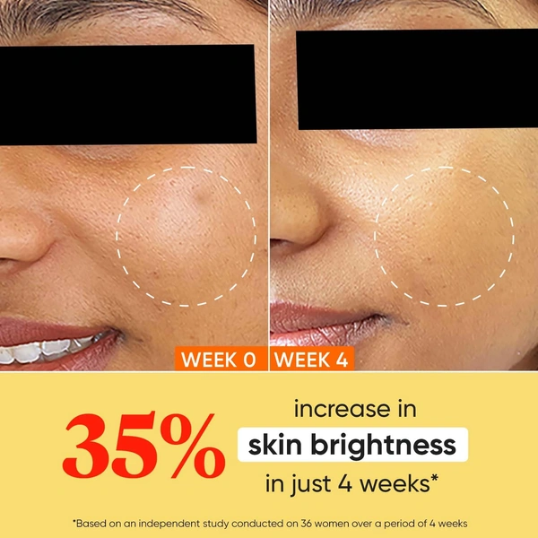 Dot & Key Vitamin C + E Sorbet Super Bright Moisturizer | for Radiant & Hydrated Skin | Smooths & Softens | Non Sticky & Quick - Absorbing | Oil Free & Lightweight | For All Skin Types | 60ml